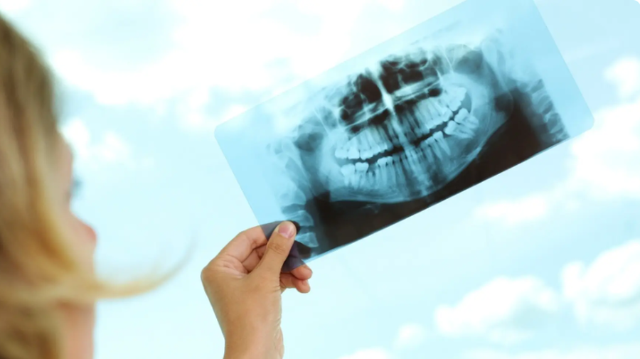 كلّ ما يجب معرفته عن زراعة