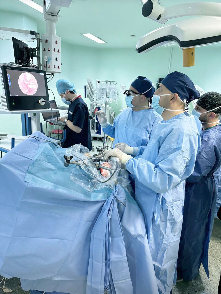 إجراء عمليات بالمنظار المرن لعلاج الاستسقاء