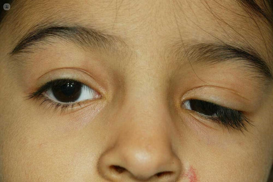 ما لا تعرفه عن حالة تدلي