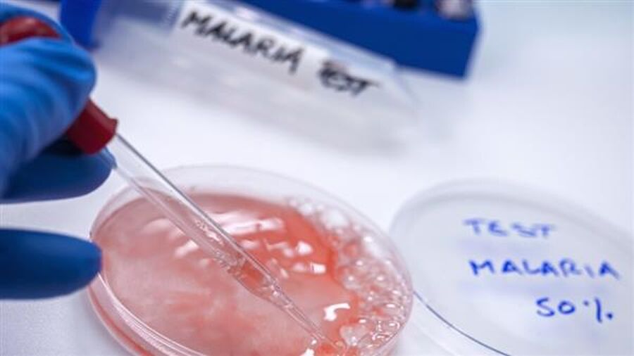 دراسة: مادة موجودة في جميع المعلبات