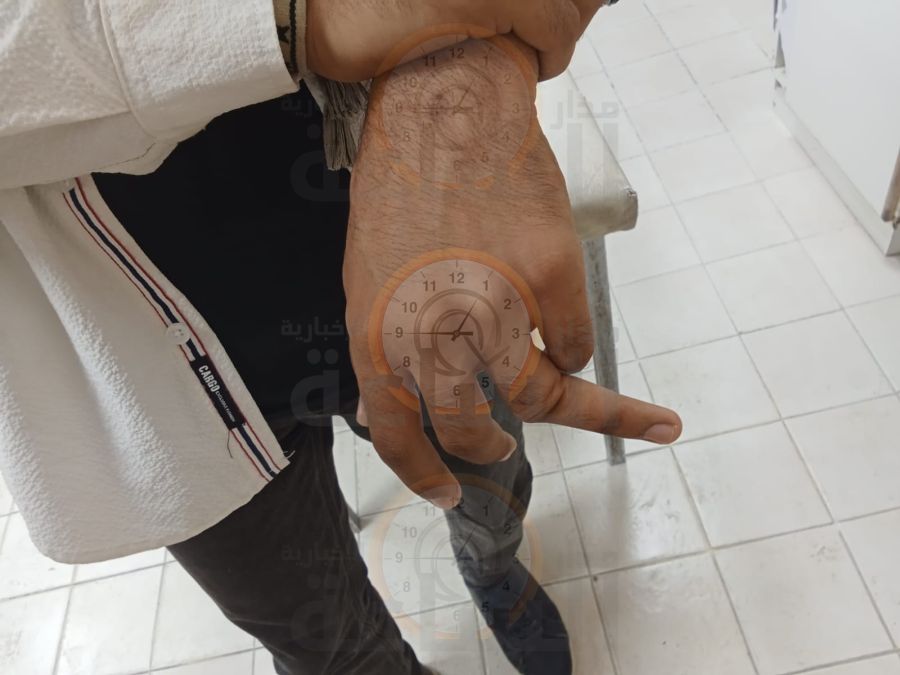 معلم في اربد يعتدي بطريقة وحشية