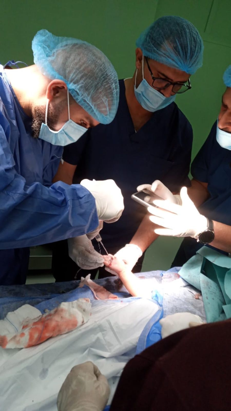 الدفاع المدني يحرّر يد طفلة علقت