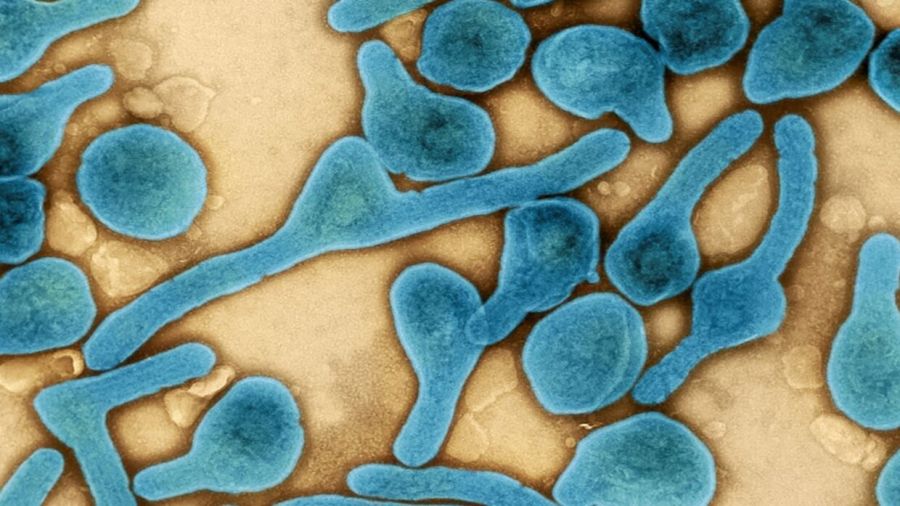 دولة إفريقية تعلن وفاة 8 أشخاص