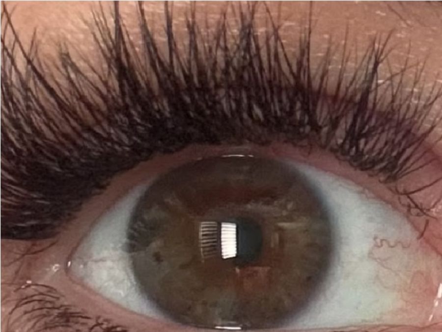 في حادث غريب.. صاعقة برق تصيب