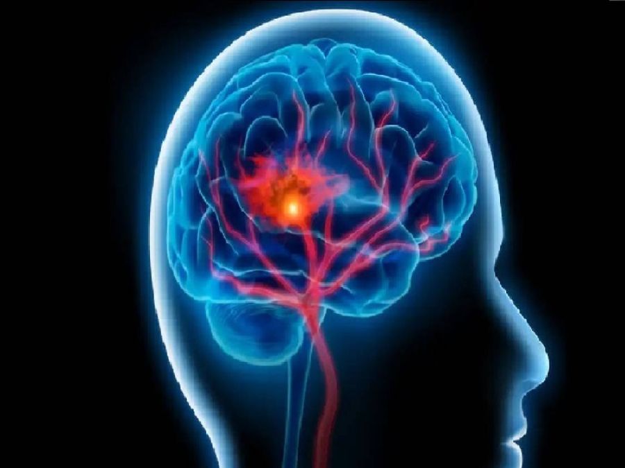 دواء ثوري لعلاج تلف الدماغ بعد