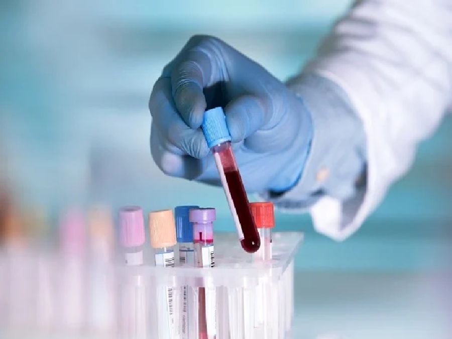 اختبار دم يرصد 12 نوعا من