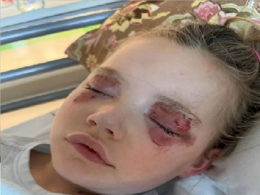 الأم تحذر.. كبسولة منظف ملابس تتسبب