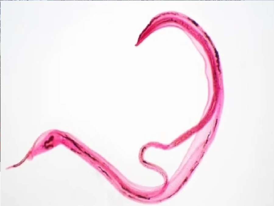 تحذيرات من دودة طفيلية خطيرة تنتشر