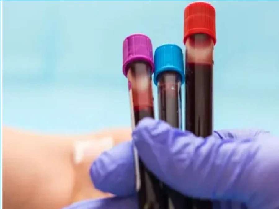 اختبار دم يشخّص أخطر الاضطرابات الوراثية