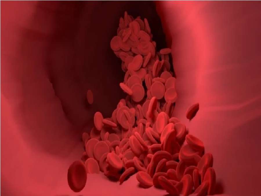 أداة مبتكرة لرصد سرطان الرحم والالتهابات