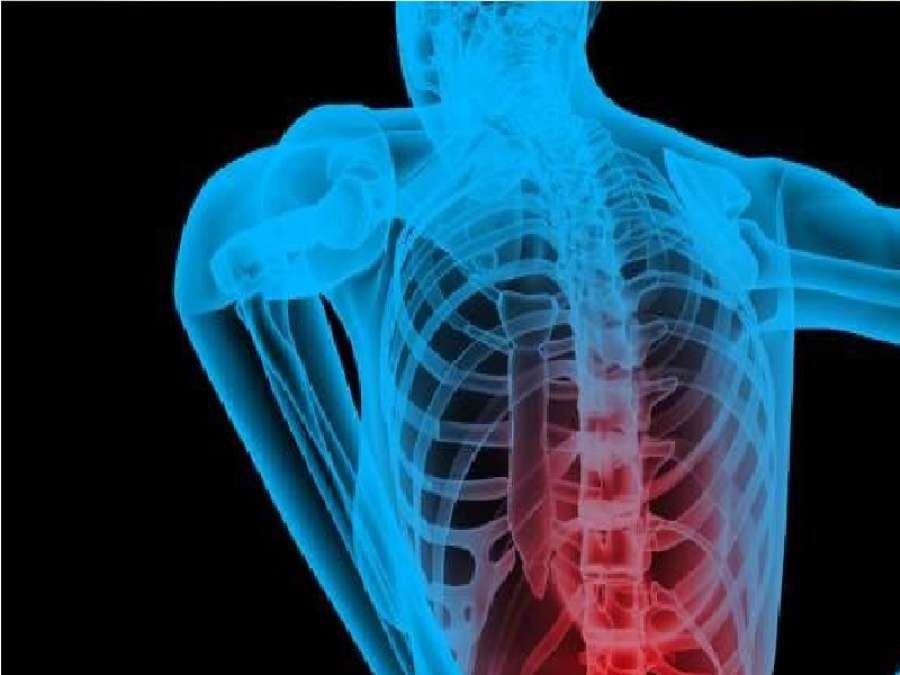 7 أفكار خاطئة عن آلام الظهر