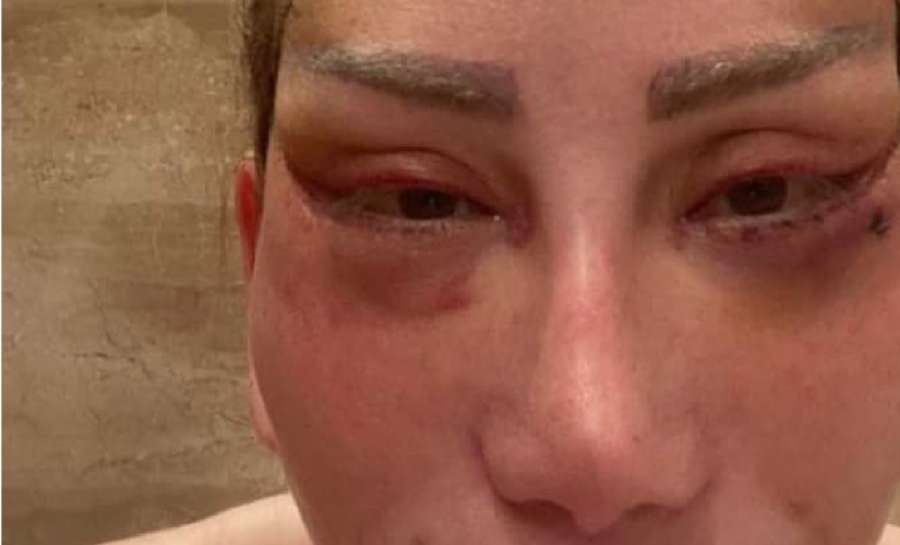 تسبب تشوهات مزمنة.. أطباء يحذرون من