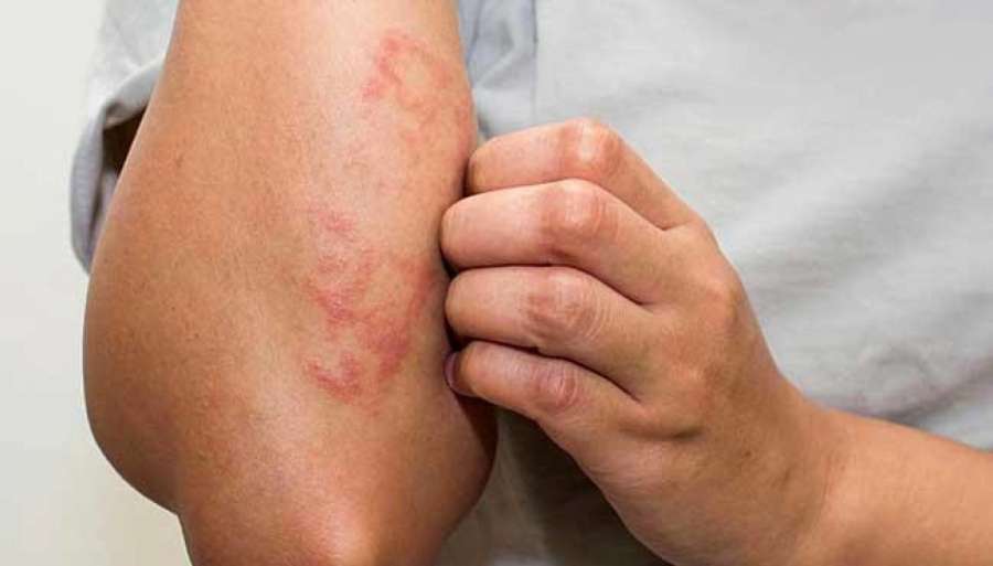 قد يسبب عدوى خطيرة.. مضيفة تحذر