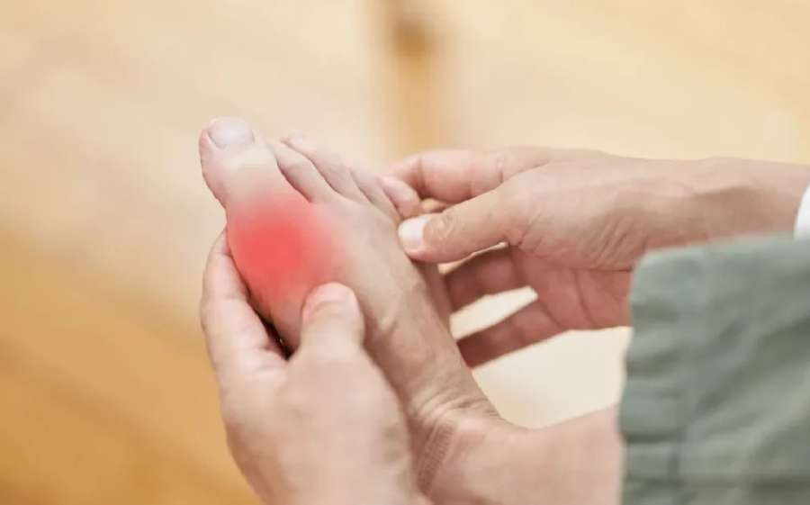 علامة في كاحل القدم تكشف ارتفاع