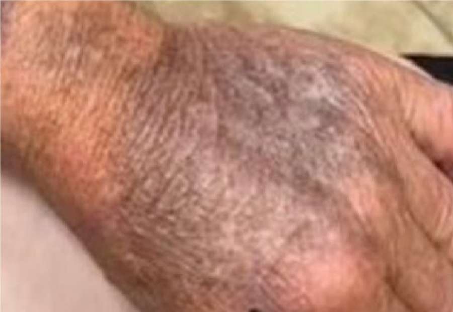 لا تهمل واقي الشمس بعد الآن..