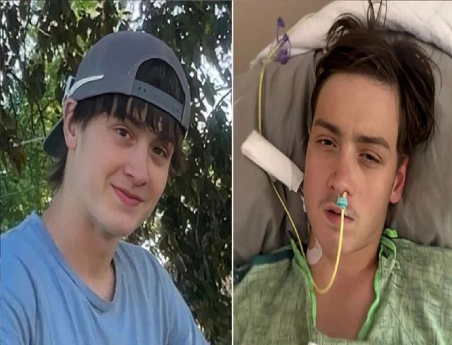 لدغة عنكبوت كادت تقتله.. مراهق يصارع