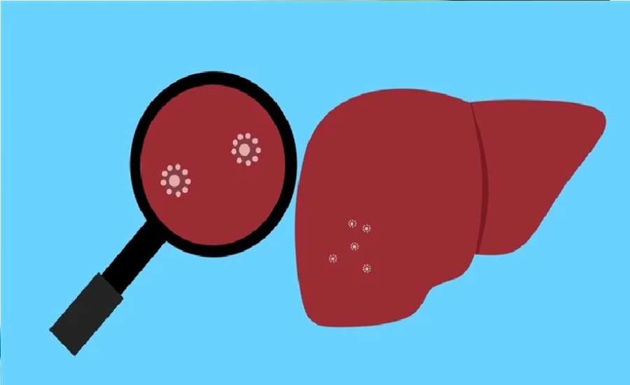 حقائق جديدة عن احتمالات الوقاية من