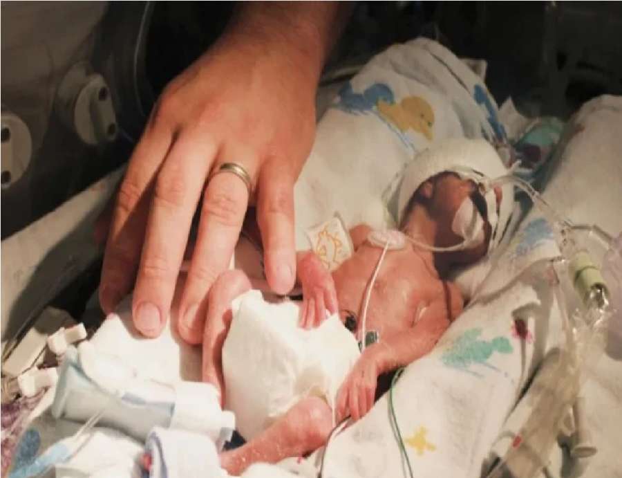 الولادة المبكرة ترتبط بمخاطر صحية ونفسية