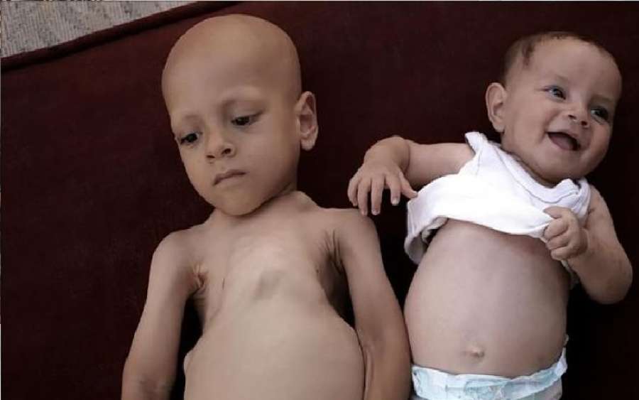 مأساة عبدالله وحبيبة أبوزرقة.. هل من