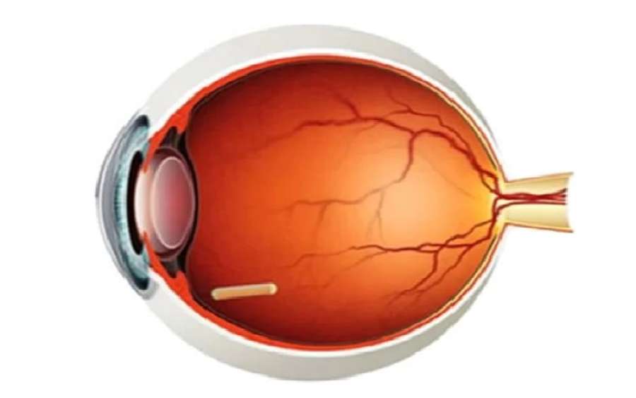 علاج جراحي جديد يقي العيون من