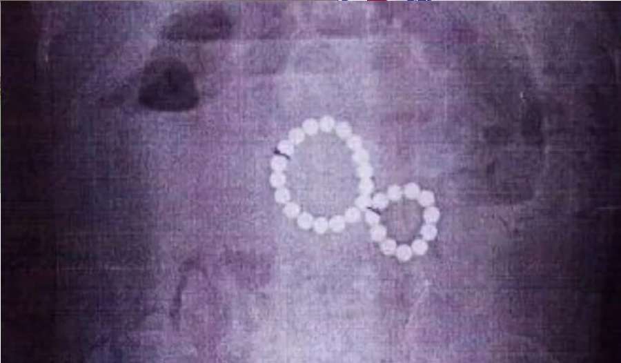 كادت تودي بحياتها.. العثور على 29