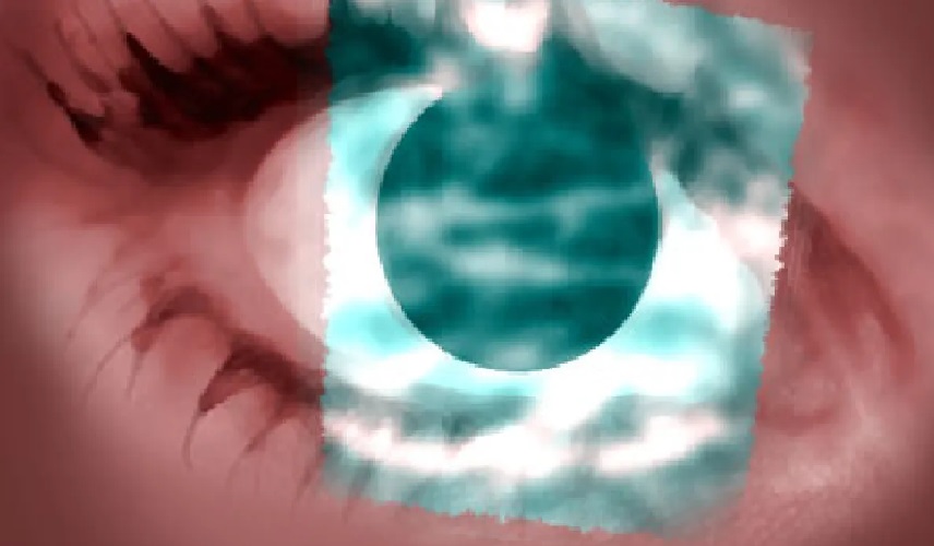 بعد 10 سنوات من العمى.. سبعينية