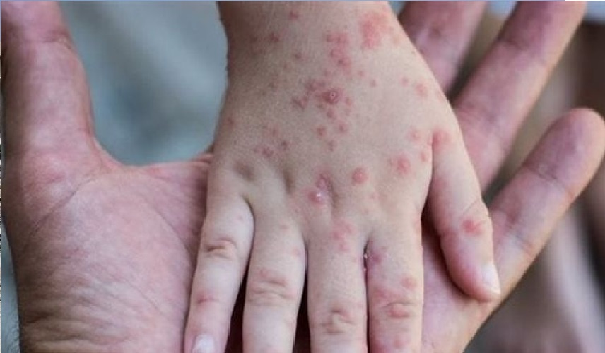 أودت بحياة طفلين.. تكساس تطوي صفحة