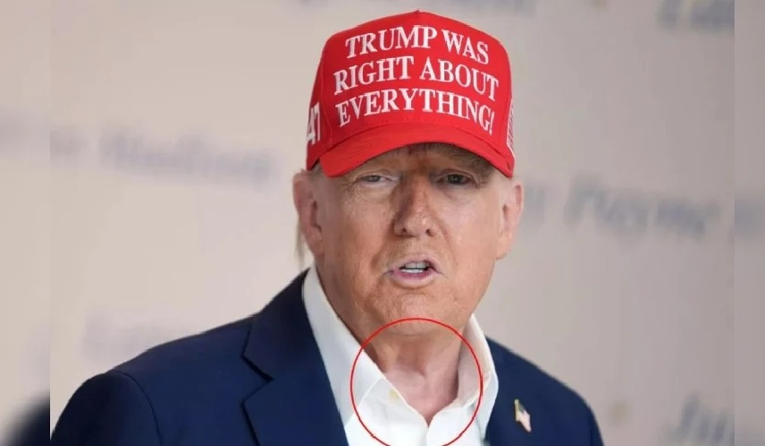 خطأ تجميلي يضع ترامب في موقف