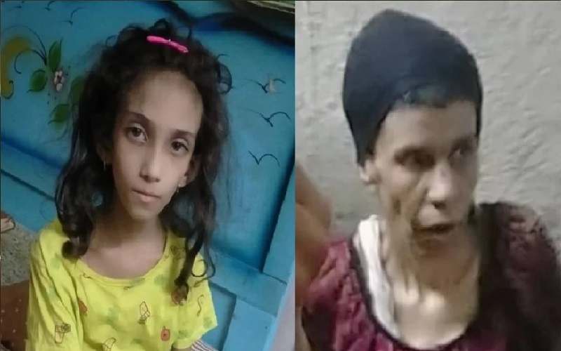 تحولت أجسادهن لهياكل عظمية.. أول تحرك