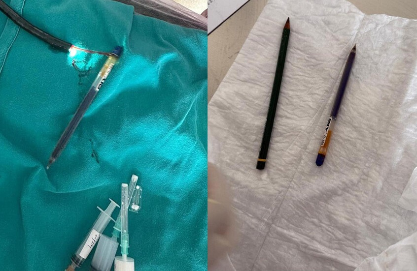 بسبب اضطراب نادر.. استخراج قلمين من