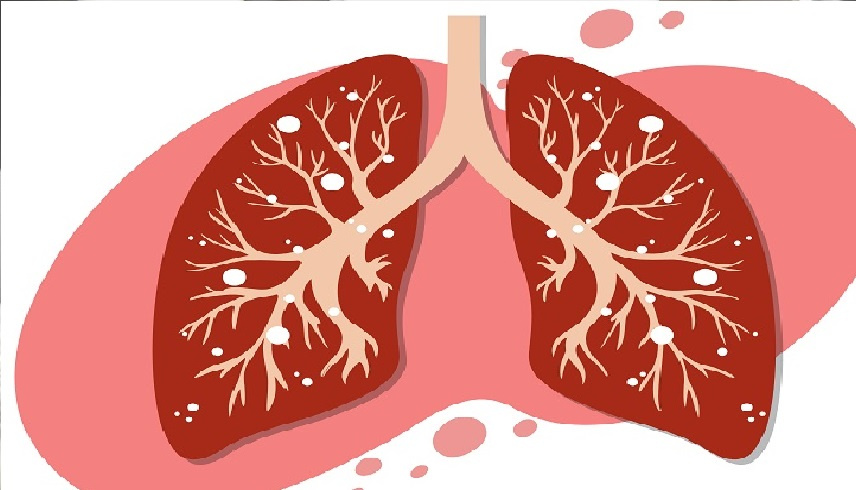 دراسة: الربو النشط لدى الحامل يزيد
