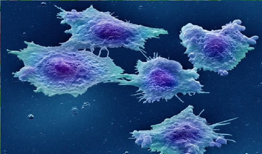 في 30 دقيقة فقط.. علاج رائد