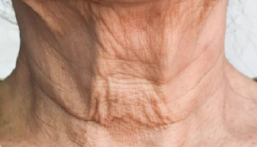 متلازمة الهاتف: كيف يسرق جهازك المحمول