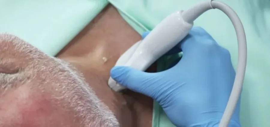 فحص بسيط يكشف خطر الإصابة بالنوبات