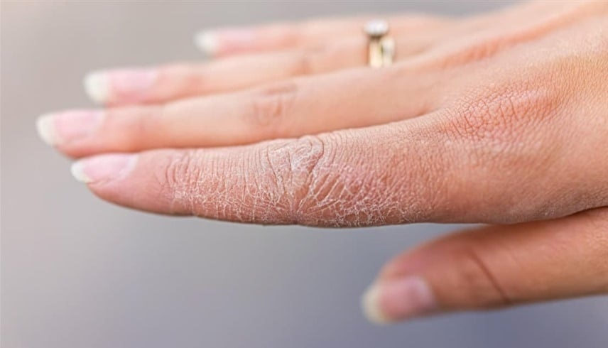 جلدك يصرخ بالإنذار: لا تتجاهل هذه