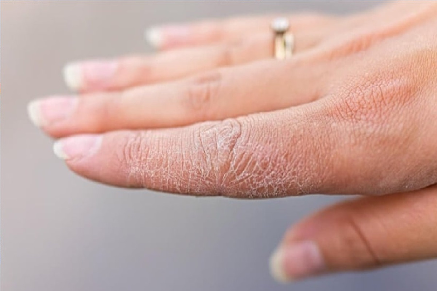 شاهدها قبل فوات الأوان: بشرتك هي