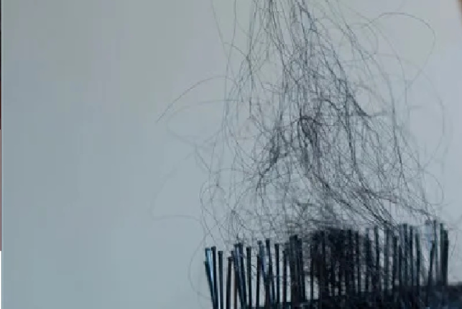 هرمون النورإبينفرين القاتل: التوتر يقتل خلايا