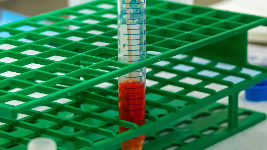 مفاجأة طبية.. فصيلة دم قد تزيد