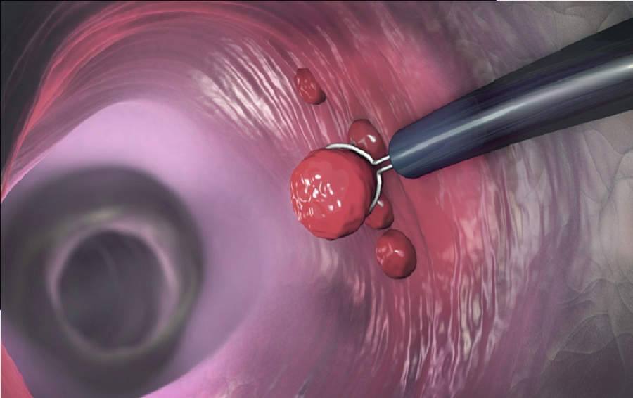 الطريق إلى الشبع: عادات صحية تزيد