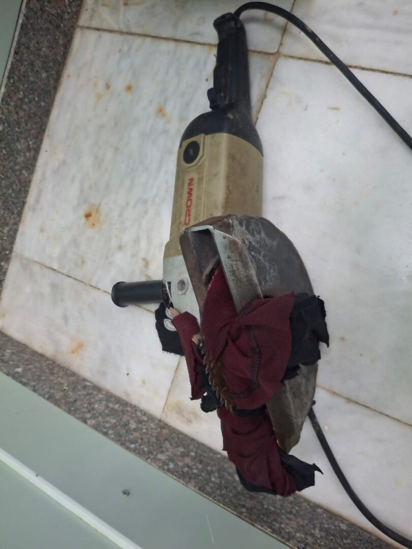 في واقعة نادرة.. استخراج منشار كهربائي