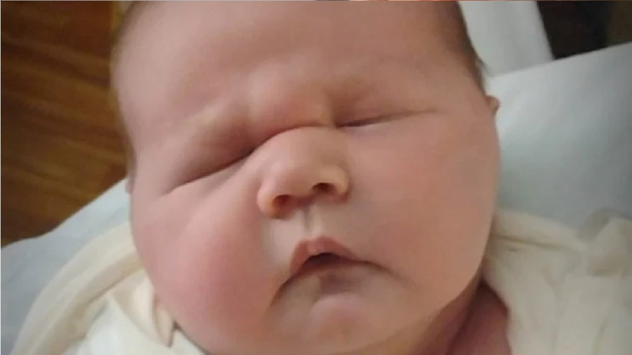 طفل الـ 6 كيلوغرامات: ولادة عملاق