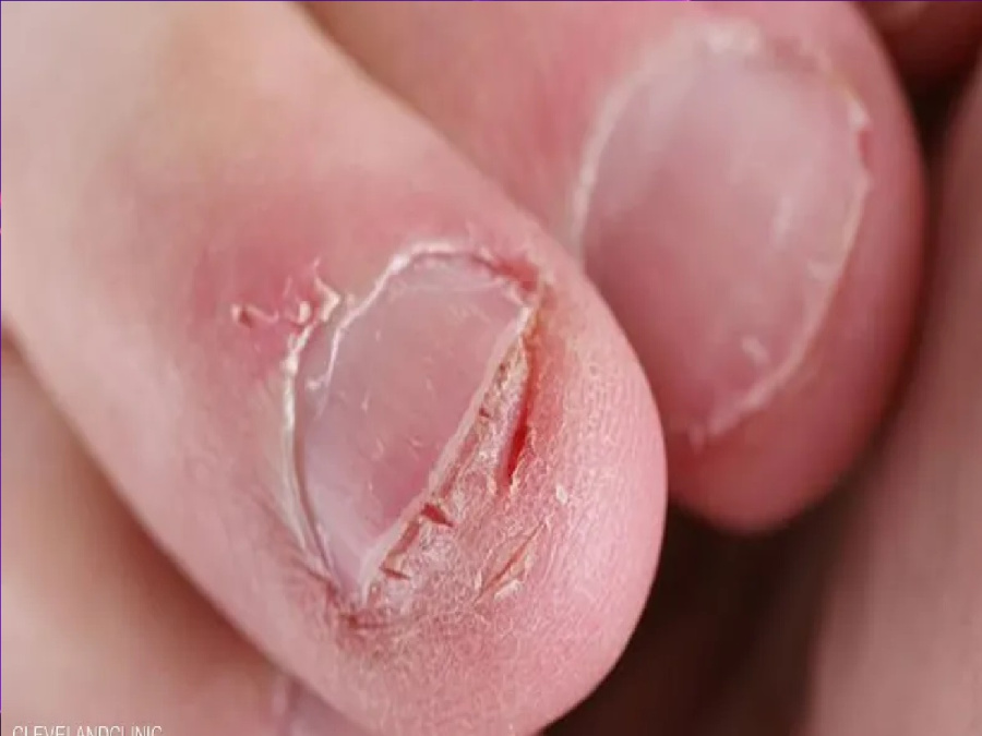 هل يخدعك عقلك؟ حقيقة الاختطاف العصبي