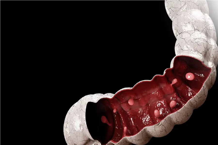 دراسة صينية حديثة تكشف علاقة الكافيين