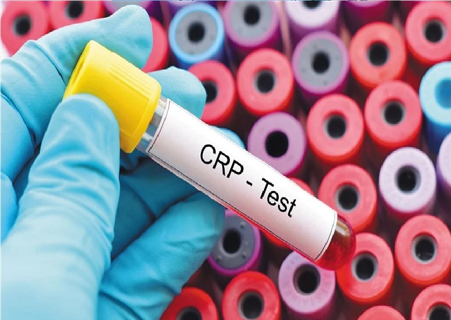 باحثون يكشفون عن جزيئات دهنية قادرة