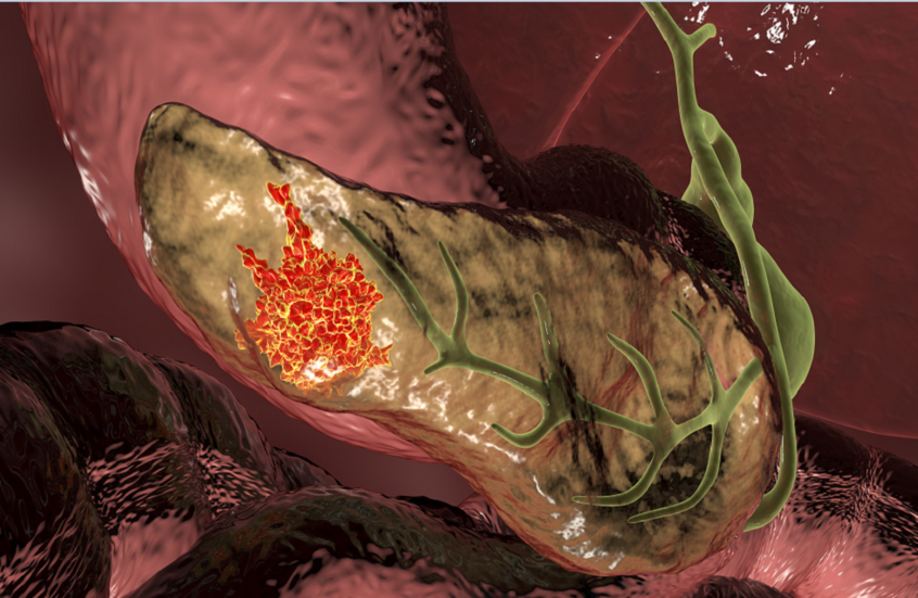 تجربة دوائية رائدة تحقق اختفاء دائما