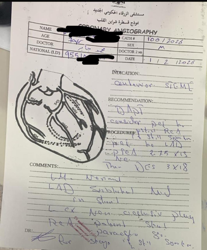 الأردن: إنقاذ حياة أول مريضين بعد