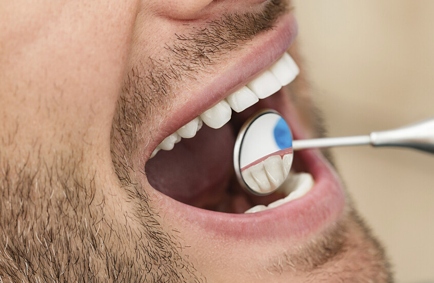 اكتشاف سبب غير متوقع لتدهور صحة