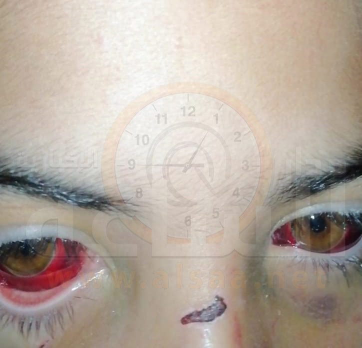 تفاصيل جديدة في قضية خطف واغتصاب