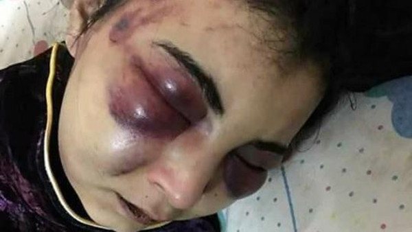 ماذا فعلت هذه المصرية حتى عذبها