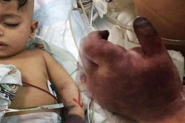 فيديو: الأطباء الألمان اكتشفوا وجود خطأين